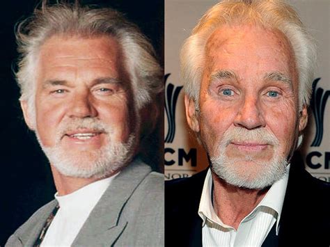 bad plastic surgery kenny rogers